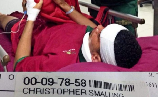 La insólita 'lesión' de Chris Smalling en su vacaciones en Indonesia