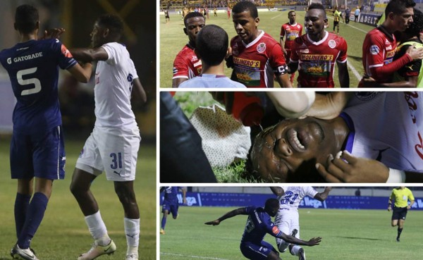 FOTOS: Semifinales de patadas, gritos, insultos y golpes en Honduras