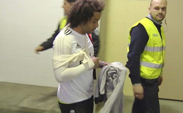 Marcelo sufre una luxación acromioclavicular en el hombro derecho