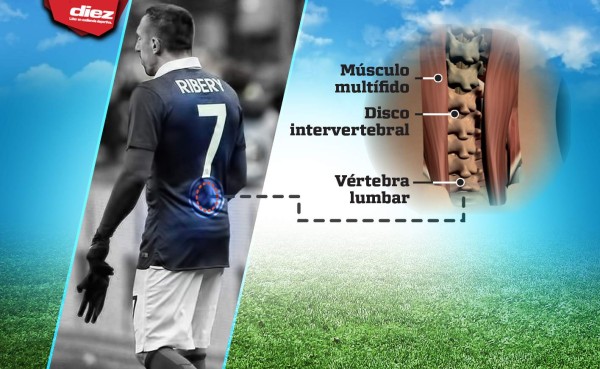 Franck Ribery se pierde el Mundial de Brasil por lesión