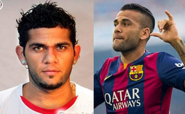 Futbolistas que se han hecho cirugía estética para verse mejor