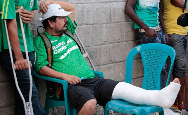 'Colocho' presenció enyesado el clásico Marathón-Real España