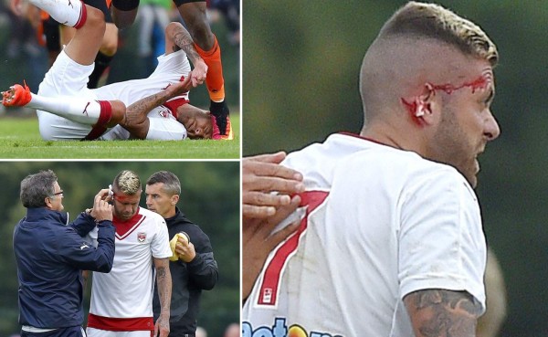 Le arrancan oreja a futbolista Jeremy Menéz en Francia