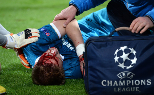 VIDEO: El duro rodillazo de Lewandowski a Tomas Hubocan