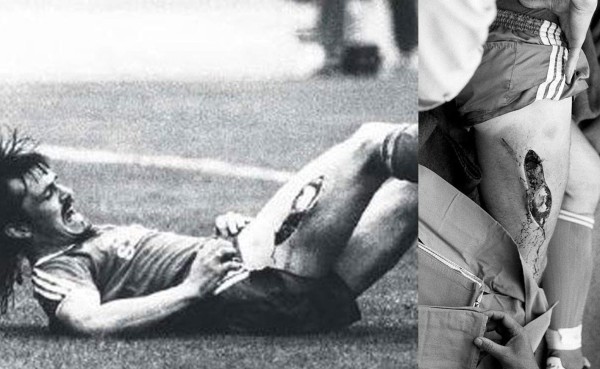 Las lesiones más escalofriantes del mundo del fútbol