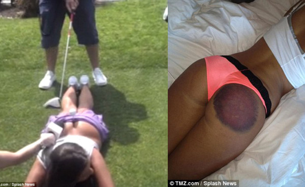 VIDEO: Modelo demanda a Playboy por golpe fallido de golf