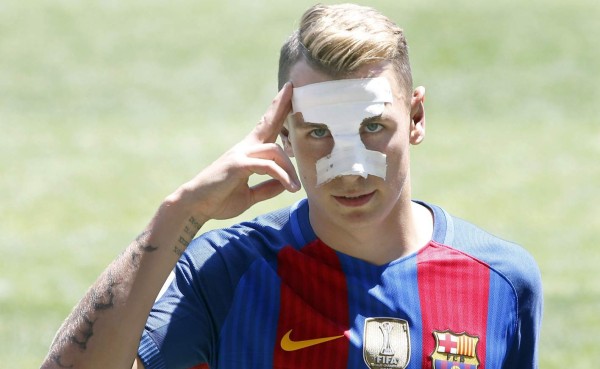 ¿Por qué Lucas Digne apareció con un vendaje en el rostro?