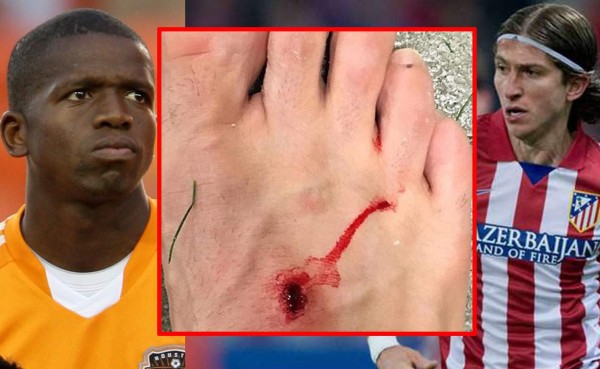 VIDEO: El día que Filipe Luis lesionó duramente a Boniek García