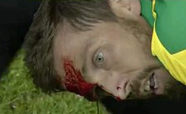 VIDEO: Brutal choque entre jugadores del Norwich City frente al Chelsea