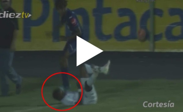 VIDEO: El pisotón en la cara de Henry Figueroa a Kevin Álvarez