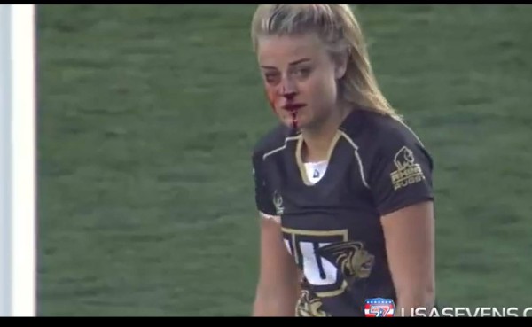VIDEO: Georgie Page, la diosa de la guerra que jugó con la nariz rota