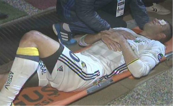 ¡TERRIBLE! Van Persie podría perder un ojo tras un duro golpe