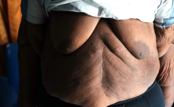 Impresionante: El tremendo cambio físico del niño más obeso del mundo que desea ser futbolista&nbsp;&nbsp;