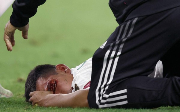 Escalofriante: así quedó el rostro de Chucky Lozano tras el duro choque con el portero de Trinidad y Tobago en la Copa Oro