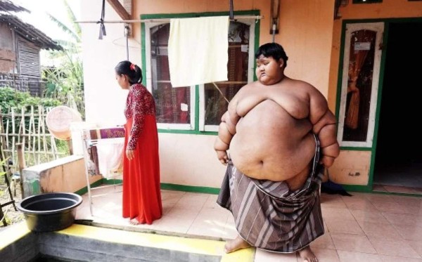 Impresionante: El tremendo cambio físico del niño más obeso del mundo que desea ser futbolista&nbsp;&nbsp;