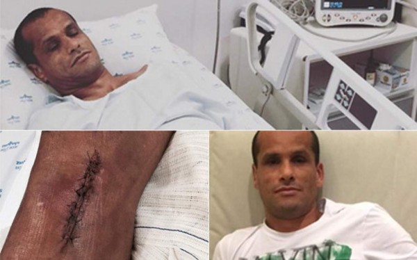 Las espeluznantes y temibles operaciones a los futbolistas