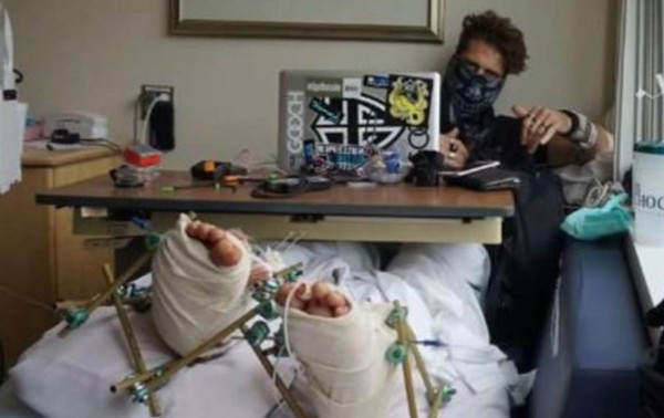 Youtuber se quebró las piernas por hacer 'Balconing'