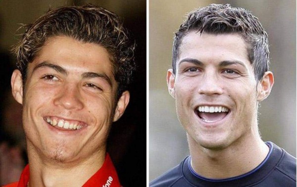 Los cambios físicos que han tenido las estrellas del fútbol