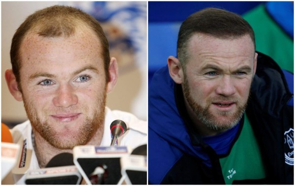 Héctor Herrera y las otras figuras que cambiaron su imagen tras cirugías