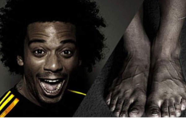 ¡HORRIBLES! Así son los pies más feos de los deportistas famosos