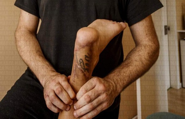 Impactante: La lesión que tiene retirado del fútbol a bicampeón de Euro con España