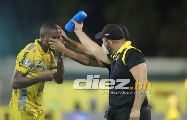 Lo que no viste en TV en la jornada 9: bellezas, beso apasionado de Pereira ¡y graves heridas a dos jugadores!