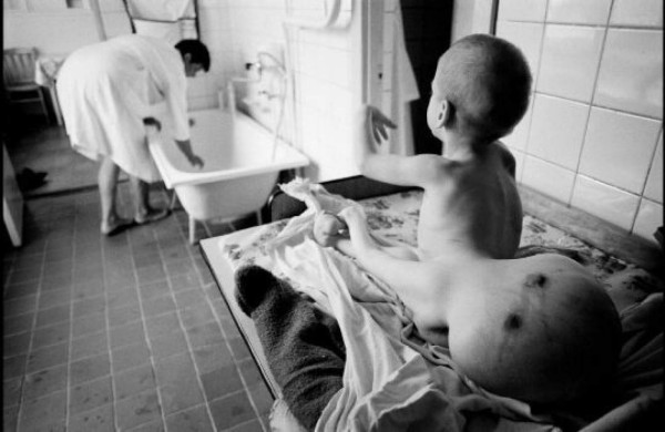 Impactantes fotos: los rostros de los sobrevivientes a la explosión de la planta nuclear de Chernobyl