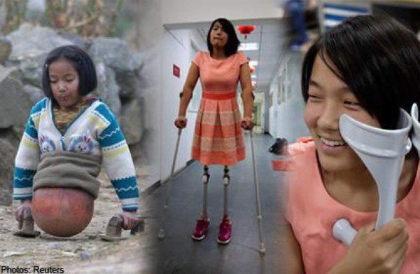 REPORTAJE: La increíble historia de una niña china, sin piernas y campeona de natación