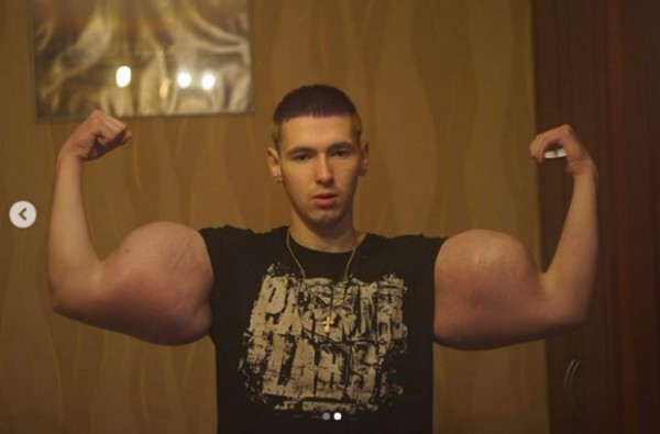 La terrible pesadilla que vivió el 'Popeye' ruso: ''Estaba tirado sintiendo que me moría''