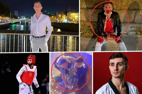 Impactantes imágenes: Ataque brutal a atleta olímpico gay que fue sometido a reconstrucción facial