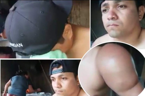 El drama de un futbolista amateur con un extraño cáncer en su hombro