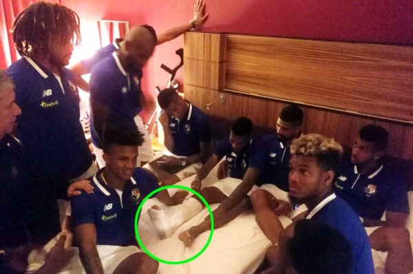 ¡Lamentable! Panameño Alberto Quintero se pierde el Mundial de Rusia 2018