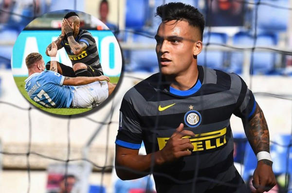 Vidal recibe insólito manotazo en el empate del Inter de Milán ante Lazio por la Serie A