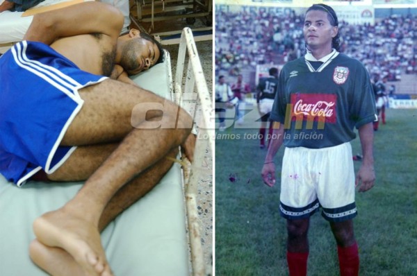 Deportistas que han sido hospitalizados por problemas con drogas y alcohol