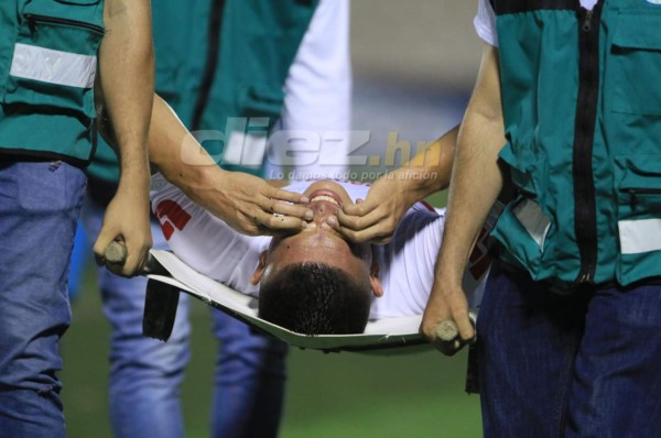 Lesión que sufrió Jonathan Paz no es nada grave y podrá estar ante el Forge FC&nbsp;&nbsp;