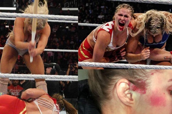 Ronda Rousey muestra sus impactantes lesiones tras la paliza en la WWE