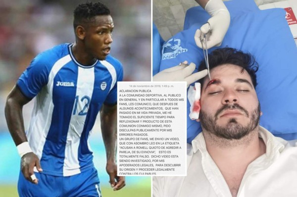 Romell Quioto pide disculpas públicas y aclara supuesta agresión a un actor&nbsp;&nbsp;