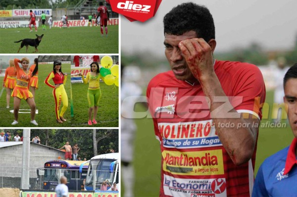 Sangre, abejas, chicas lindas y besos en las fotos curiosas de la fecha 7&nbsp;&nbsp;