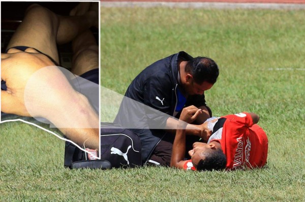 Olimpia pierde a Diego Reyes quien regresaría hasta las semifinales