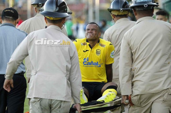 Las plagas de lesiones que azota gran cantidad de jugadores en Honduras