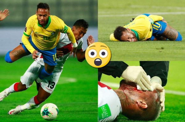 Fotos del Perú - Brasil: Las patadas a Neymar y la sangre de Miguel Trauco