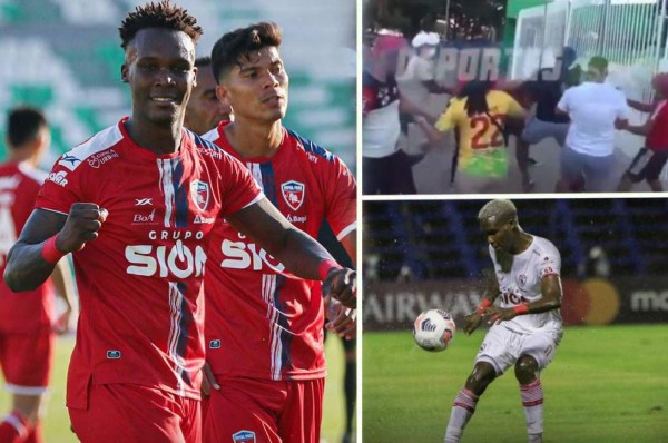 Rubilio Castillo, fuera de la convocatoria del Royal Pari ante Always Ready tras brutal agresión