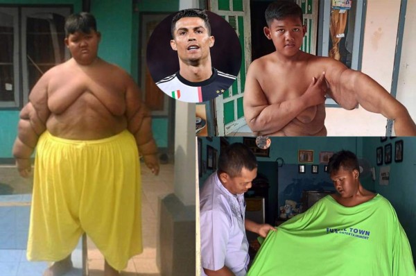 Impresionante: El tremendo cambio físico del niño más obeso del mundo que desea ser futbolista&nbsp;&nbsp;