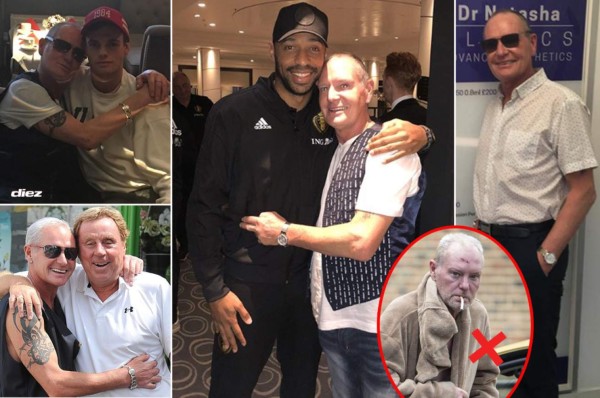 Pastillas anti alcohol: La costosa y radical operación que salvó la vida de Paul Gascoigne