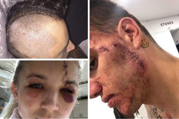 Escalofriantes: Las cicatrices más impactantes que han sufrido futbolistas y otros deportistas