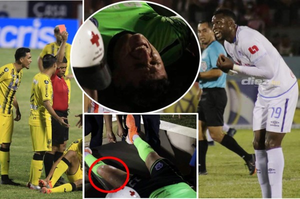 Dramáticas imágenes de Harold Fonseca y el detallazo en la camisa de Emilio Izaguirre