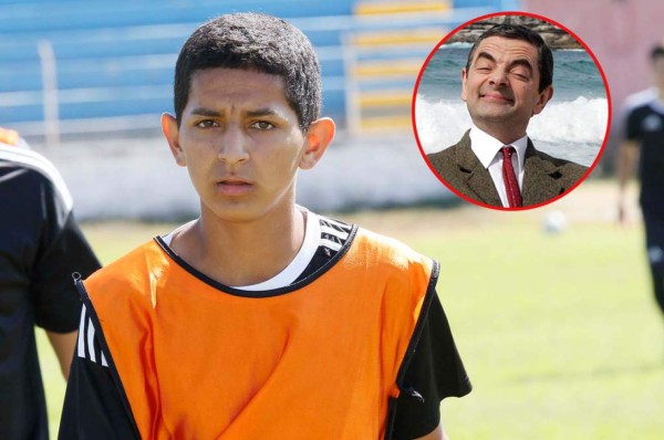 Santos FC de la Liga de Ascenso tiene a su Mr. Bean en la defensa