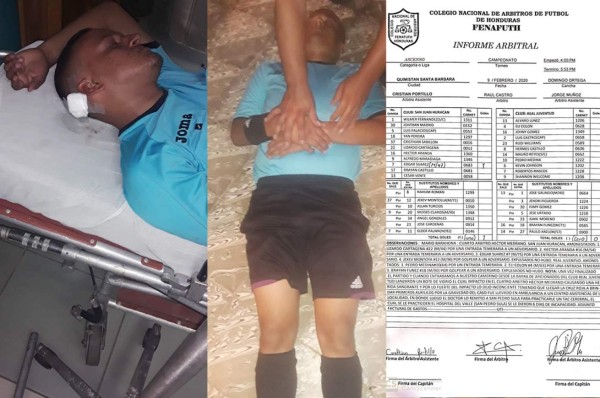 El Real Juventud es duramente castigado tras la agresión con una botella a un árbitro