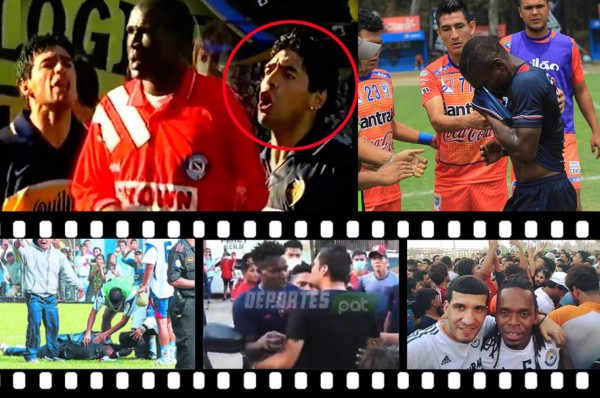 Baño de aceite quemado, uno apaleado y otro apedreado: futbolistas hondureños que fueron agredidos en el extranjero