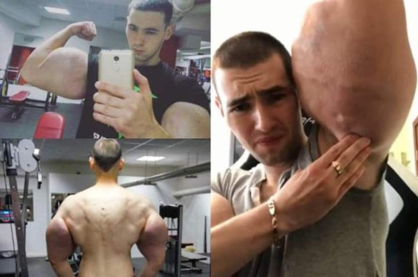 La terrible pesadilla que vivió el 'Popeye' ruso: ''Estaba tirado sintiendo que me moría''